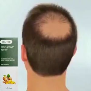 Hair Growth Serum Meningkatkan Pertumbuhan Rambut Dan Mencegah Rambut Rontok penumbuh rambut Anti Rontok cod