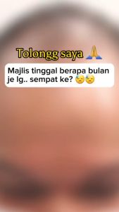 Baby Oil Kemiri Serum - Buah Keras Asli + Premium Quality Herb - Lebatkan rambut bayi Melebat rambut Baby