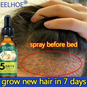 Pertumbuhan Rambut Untuk Pria Dan Wanita Minyak Penebalan Rambut Ginger Germinal Oil Minyak Esensial Perawatan Rambut Rontok 30ML