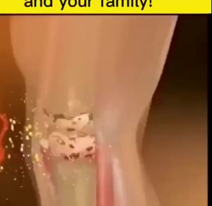 Lumbar spine jenis kompres sejuk gel sakit pinggang masalah cakera lumbar rawatan kompres sejuk 腰椎型冷敷凝胶腰痛腰椎间盘突出症冷敷治疗
