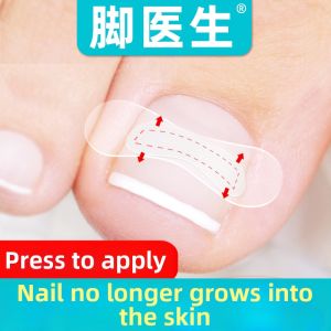 JIAOYISHENG | Nail Correction Sticker