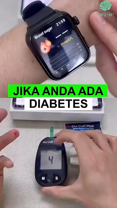 Jam Tangan Non-Invasive Blood Glucose Blood Lipid Uric Acid ECG