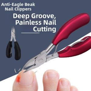 Ingrown Toenail Clippers