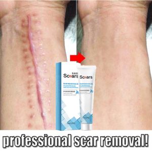 ครีมกระชับสารหนักผิว รอยแผล และเสร็จหลัง Scar Repair Gel สำหรับการฉีดบริเวณบริเวณบริ๊ก และควบคุมความเบล่าในบริเวณ เพื่อให้ผิวดูสวยงามและเปลี่ยนแปลงรูปร่างกรณ์
