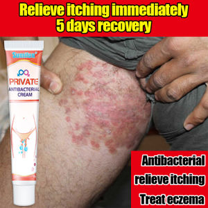 5 days to recovery! sumifun private antibacterial cream 20g treats eczema dermatitis itching psoriasis allergies and odor caused by genital fungi（eczema treatment cream antibacterial cream anti itch cream for skin gamot sa kati kati sa balat）