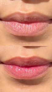 Madame Gie #LiPill Serum - Lip Oil Bibir 5ml original