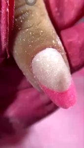 Đầu mài phễu loại bỏ gel tràn da chết