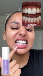 Serum Làm Trắng Răng Smilekit V34 Tẩy Trắng Răng Tại Nhà Hiệu Quả Sau 7 Ngày Brosi Kem đánh răng 30g