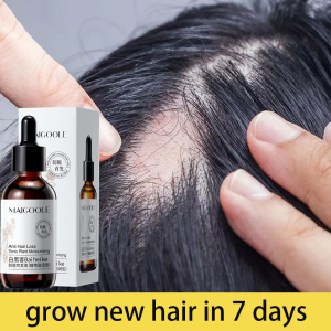 hair growth serum anti hair loss serum pertumbuhan rambut Herbal extract 60ml 头发生长液 Say Goodbye To Baldhead hair care