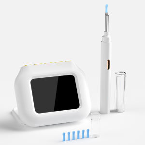 2.8 Screen Point-to-Point P2P Smart Ear Camera 4.2mm Otoscope Digital Ear Pick Video Ear Cleaner Endoscope LED Ear Wax Removal