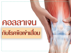โดยคู่มือที่นำไปสู่คุณค่า คอลลาเจนช่วยให้กระดูกแข็งแรงและความงาม เพื่อให้กับคุณค่าที่ดีที่สุด ราคาถูก คอลลาเจนแบบชงเพียว 100000 ช่วยเสริมความสะอาดและความยืดหยุ่นในช