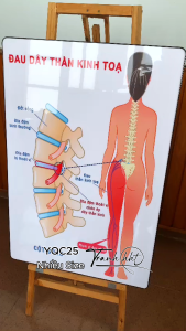 Tranh y khoa treo tường Tranh phòng khám Y khoa đau dây thành kinh tọa tráng gương treo tường YQC25