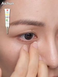 Aichun ครีมลดถุงใต้ตา 30ml ปรับปรุงอนุภาคไขมันลดถุงใต้ตา อายครีม ครีมไต้ตา ดูแลรอบดวงตา ครีมทาใต้ตาดำ ครีมบำรุงรอบดวงตา อายเจล ครีมใต้ตา ครีมบำรุงขอบตา ครีมทาถุงใต้ตา ครีมทาตาดำ ครีมแก้ขอบตาดำ ครีมทารอบดวงตา ครีมบำรุงใต้ตา