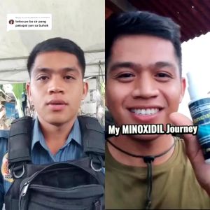Original Minoxidil Strands 6% Minoxidil Premium Hair Grower Topical Solution Hair Grower Minoxidil