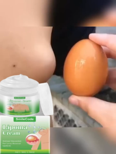 Lipoma Removal Cream Treat Tumor Skin Swelling Ointment Herbal 50G Treat Tumor Skin Swelling Ointment Herbal It Can Effectively Reduce Inflammation Remove Lipomas Fibroids And Subcutaneous Masses And Relieve The Pain And Lump Lipoma Removal Ointment