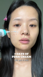 Anua - Kem Dưỡng Ẩm Phục Hồi PDRN Hyaluronic Acid 100 Moisturizing Cream - 60ml