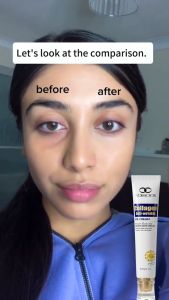 Krim Kantung Mata Penghilang Mata Panda & Anti Penuaan&keriput 20g