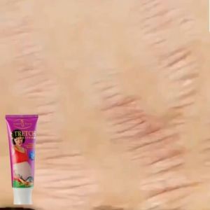 Kem Dưỡng Ngăn Ngừa Rạn Da Cho Bà Bầu Chống Rạn Da Mờ Sẹo Săn Chắc Da Chống Nhăn Sau Khi Sinh Ngừa Rạn Da Do Tăng Cân Mờ SẹoGiảm Thâm Giảm Nhăn