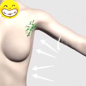 Janpanese Original Lipoma Removal Cream Tendon sheath cyst removing ointment Fat Lump Removal Dredge