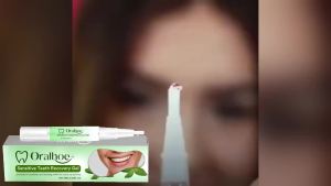 oralhoe | Rapid Repair Gum Care Gel Soothes Tooth Sensitivity Deep Cleaning Teeth Stains Dental Maintains Oral Clean Relieve Tooth Damage