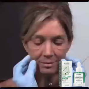 EELHOE Serum 55ml - Công thức làm dịu da nhạy cảm và trị mụn dưỡng ẩm sâu cho da mặt