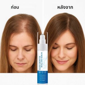 เซรั่มโรสแมรี่โรลออนบำรุงเส้นผม 25 มล. 3% โรสแมรี่ 3% Redensyl 2% Anagain ลดการหลุดร่วงของเส้นผม เซรั่มบำรุงผมสำหรับผู้หญิงและผู้ชาย