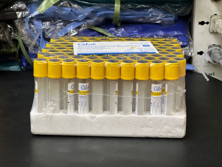 Yellow Top Blood Collection 4ml Lazada PH