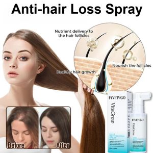【Hair Growth And Anti-hair Loss】Nourishing Hair Vitality Spray   Accelerate Hair Growth Anti Hair Loss Nourish Hair Roots Repair Damage Hair Essence