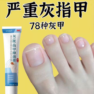 Mua 3 Tặng 2 Kem Dưỡng Ẩm Cho Móng Tay Màu Vàng Thảo Dược Loại Bỏ Tình Trạng Dày Và Mềm Móng Tay Dưỡng Ẩm Phục Hồi