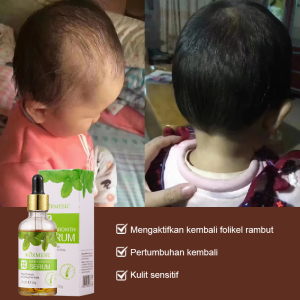 Penumbuh Rambut Anak Dan Bayi Cepat Dan Aman Baby Hair Vitamin Serum 50g Menumbuhkan Menebalkan & Menutrisi Rambut Serum Pelebat Rambut Bayi