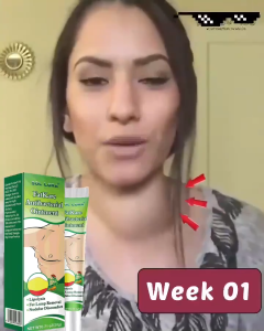 【100% Effective】Lipoma Removal Cream Treats Tumor-Related Skin Swelling Natural Herbal Ointment Relieves Pain Clears And Dissolves Effectively Reduces Subcutaneous Lumps