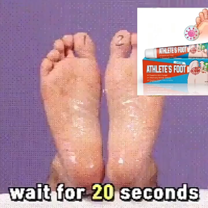 【100% Effective】Antibacterial Foot Cream Athletes Foot Treatment Cream Athletes Foot And Fungus Cream Itch Treatment Heel Crack Removal Cream Anti-Itch Deodorant Cream Athletes Foot Ointment Dry And Cracked Heel Care Fungal Inhibitor Cream 20g