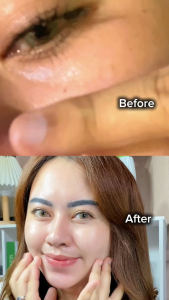 KEZIA Beauty - DARKSPOT PACKAGE SERIES -  Paket Anti Flek(FREE 1 BrightUnderarm+SettingSpray+BodySerum+SerumSkinReNew+CleansingBalm)