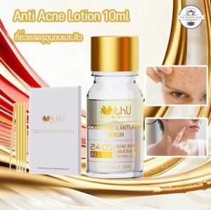 COD เซรั่มสิว 10/20/30ml ลดสิว ลดรอยแดง ลดอักเสบ กระชับรูขุมขน ใช้ได้ผลเร็ว/Cute-Ghost