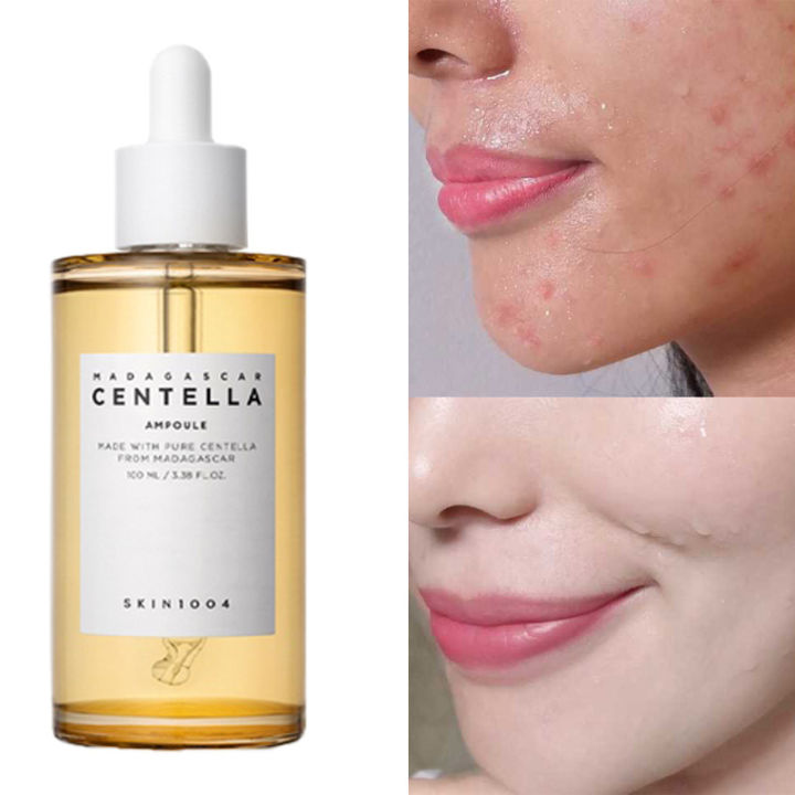 SKIN1004 Madagascar Centella Ampoule 100ml Repair skin acne marks and strengthen skin barrier