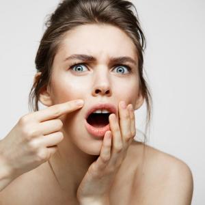 Alat Pemecah Jerawat Comedo Acne Blockhead Penekan Pemencet Komedo Facial Beuty Tools Pria Wanita