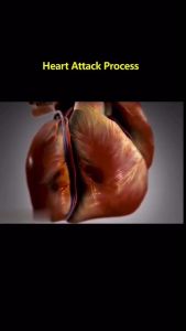 SundaZhi GMI Heart Savior 心脏的救星