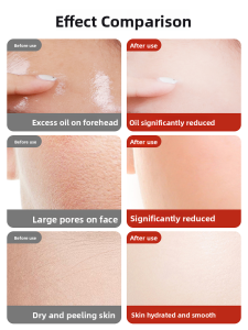 MONLEYTA | Authentic Vitamin E Body Lotion Moisturizing Nutritious Men Women Hand Cream Skin Care Cream Face Cream Rich Hydrating