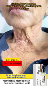 【Beli 1 gratis 1.】Serum Pemutih dan Penghilang Bintik Pelembab Niacinamide Menyegarkan Menghaluskan Kulit 30Ml