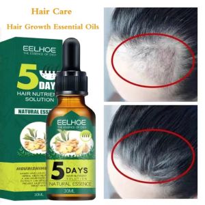 Obat Penumbuh Rambut Anti Rontok / Obat Rambut Botak Ginger Germinal Oil 5 Days Aman Terbukti 30ML