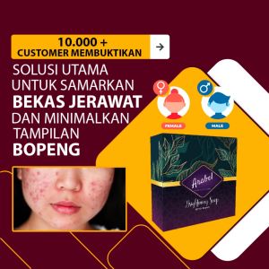 (4 SABUN) Sabun Arabel untuk Jerawat Sabun Wajah Herbal Sabun Jerawat Sabun Flek Hitam Sabun Facail Soap BPOM HALAL