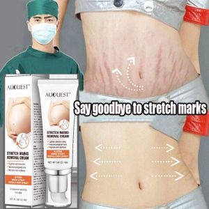 Stretch marks remover 45g Body Repair cream Firming Belly Growth Strokes Abdomen Thighs Quick and gentle and fade postpartum stretch marks obesity lines Skin Repair Cream Stretch Mark 妊娠纹霜