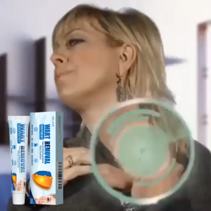 Eelhoe Wart Removal Ointment Gently Reduces Bumps Safely Fades Spots Soothes Skin Skin Care 20g