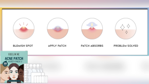 [Clear Acne Overnight!] Hydrocolloid Acne Patches Absorb Pus And Flatten Acne Ultra-Thin And Breathable Invisible Without Leaving Acne Marks Compatible With Makeup Suitable For Sensitive Acne-Prone Skin Prevents Acne Scars Waterproof And Sweatproof (306pc