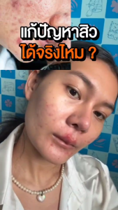 SOMSAI เซ็ทผิวใสท้าแดด - สบู่ล้างหน้า 300 ml. และกันแดดส้มใส 30 g.