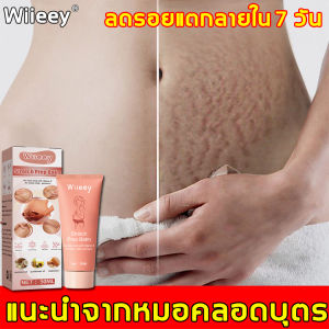 สำหรับคุณที่ต้องการลดรอยแตกลายภายใน 7 วัน โค้ด Wiieey ครีมรอยแตกลาย ส์เปรย์ลดรอยแตกลาย รอยแตกลาย สำหรับการซ่อมแซมผิวหลังคลอด ลดรอยแตกลาย หน้าท้องกระชับ ครีมทาแตกลาย ครีมทารอยแตกลาย ครีมแก้แตกลาย ครีมทาท้องลาย ครีมทาขาแตกลาย ครีมลดรอยแตก ครีมลอยแตกลาย
