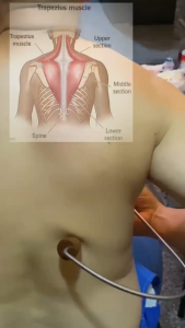 นวดคลายเส้น ไม้นวดหลัง ไม้กดจุดไม้ตะขอ ไม้สักทอง ตะขอนวด คอ บ่า ไหล่ยาว ๓๕ กว้าง ๒๒ เซนติเมตร