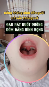 [DEAL SIÊU HỜI] Kem Thoa Làm Dịu Họng Giảm Ho Tiêu Đờm Chiết Suất Từ Thảo Mộc Thiên Nhiên Giảm Đau Ngứa Khó Chịu