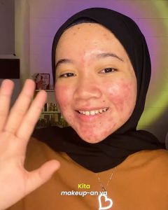 Lumecolors Lipstik Lipcoat Cheek Mousse Foundation Compact Loose Powder Pensil Alis Palet Spons Bedak Padat Tabur Lume Facial Cleanser Hydro Boost Essence Brightening Serum Moisturizer Acne Spot Treatmen Radiant Starter Charming Duo Tas Skincare