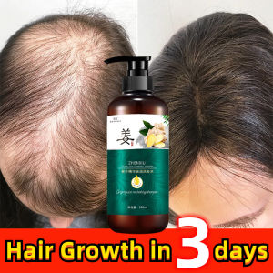 Shampoo Penumbuh Rambut Cepat Ginger Shampoo Anti Ketombe Dan Rontok Hair Care Rambut Rontok Penumbuh Rambut Botak Shampoo Penumbuh Rambut Memperkuat Akar Rambut